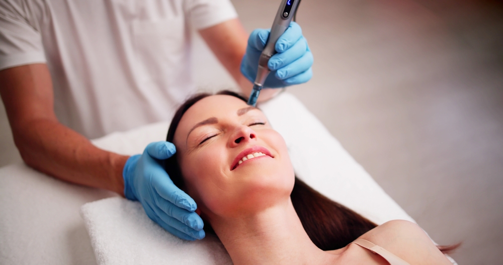 Microneedling behandeling in Hoorn